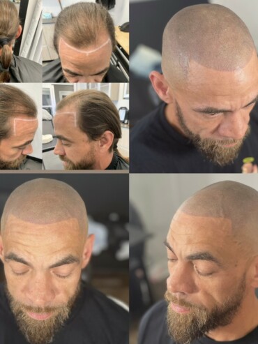 Hair appearance improvement